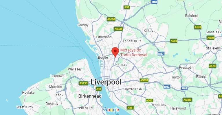 Merseyside Tooth Removal and Oral Surgery